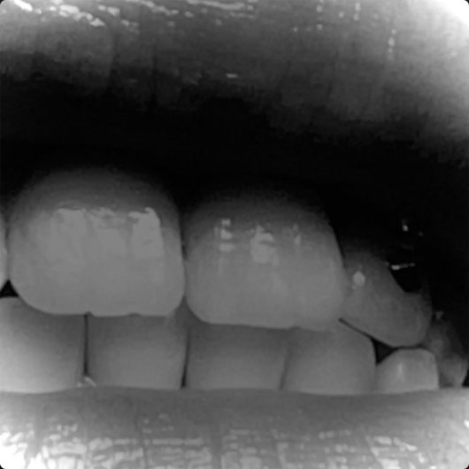 Teeth